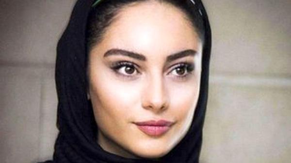 همه عمل های زیبایی ترلان پروانه در جدیدترین عکس ! ، لباس عجیبش در سینما !